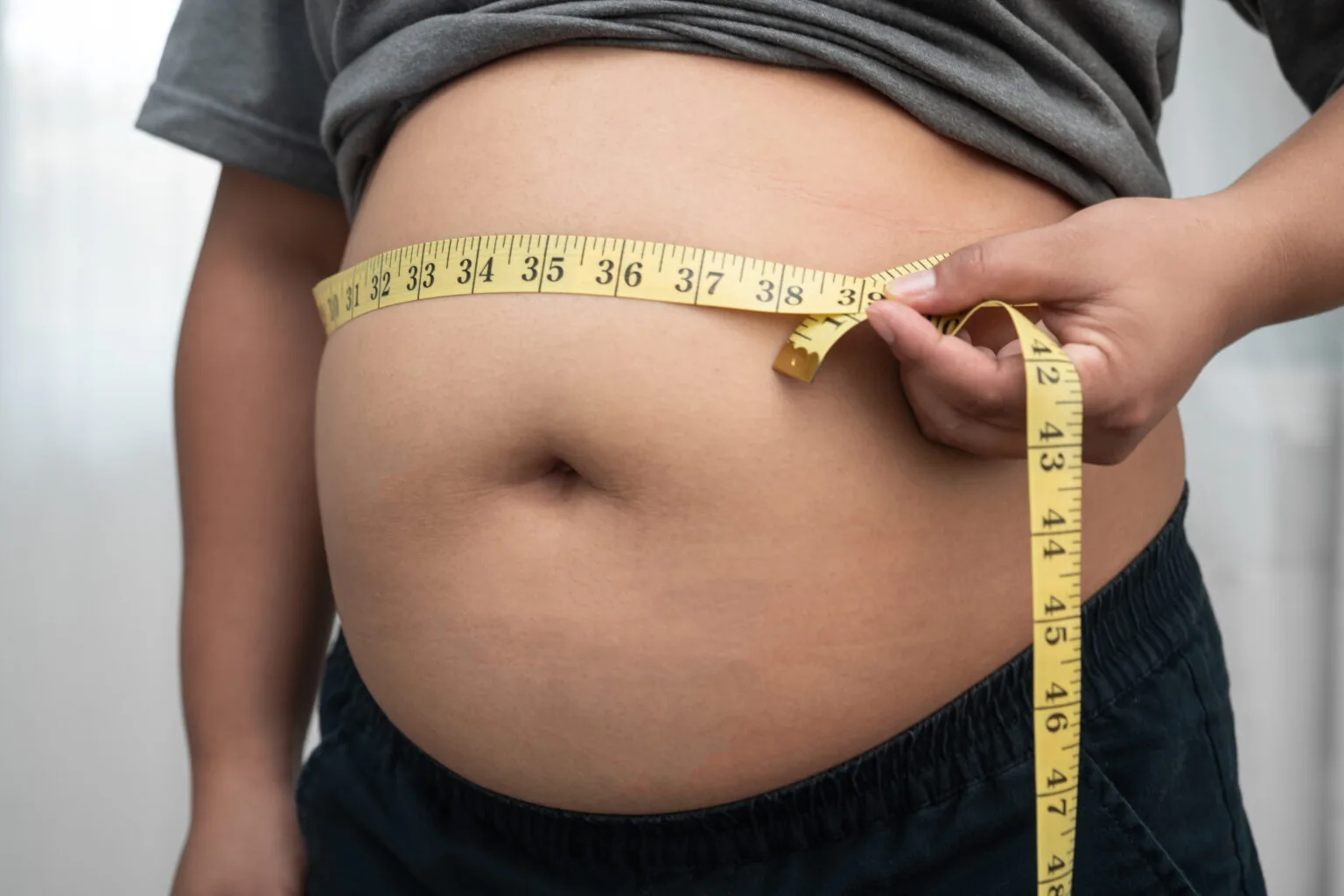 Adults Living with Obesity (Without Diabetes) — clinical trial in Orange City, FL